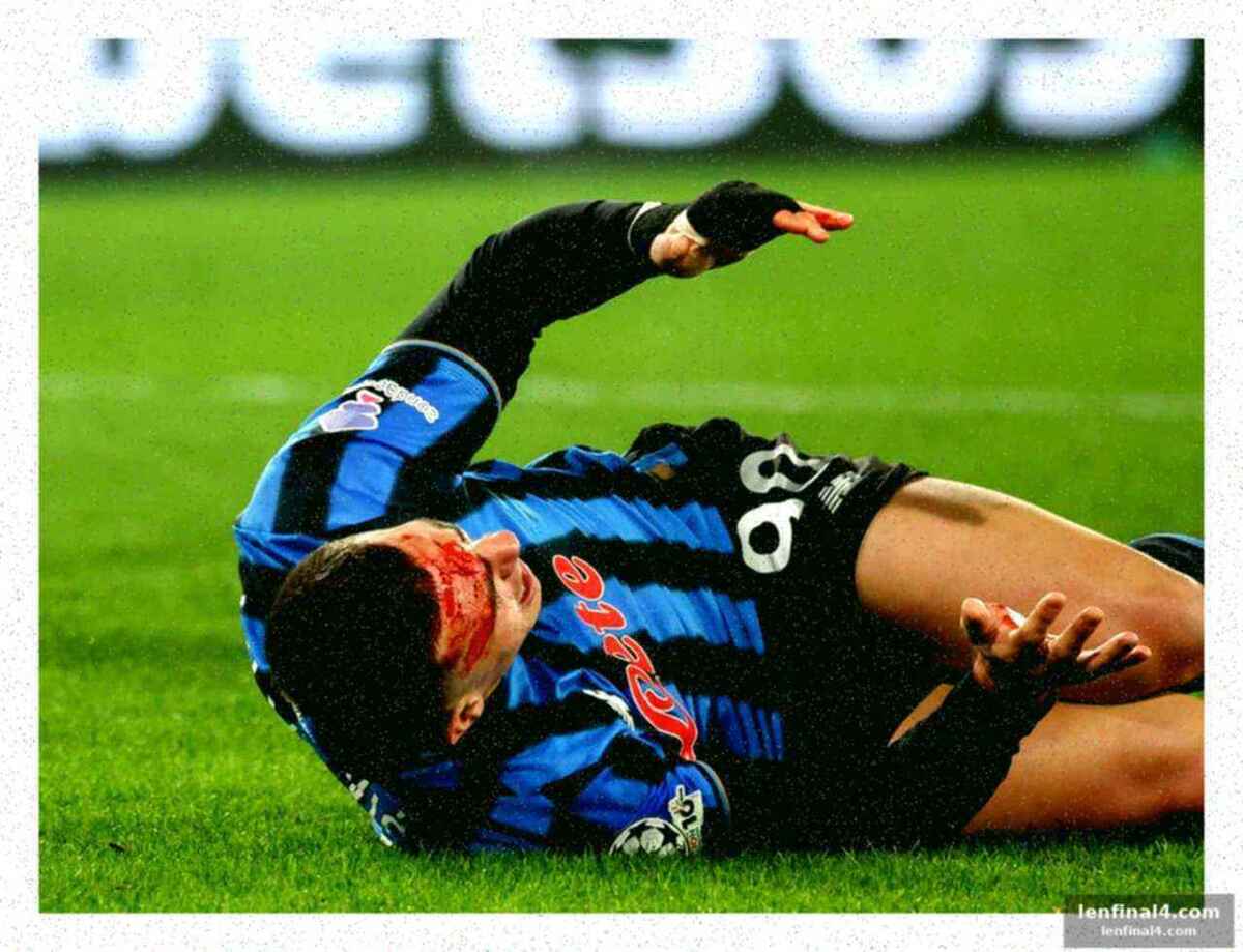 Krstovic posts images of injuries after bensebaini challenge